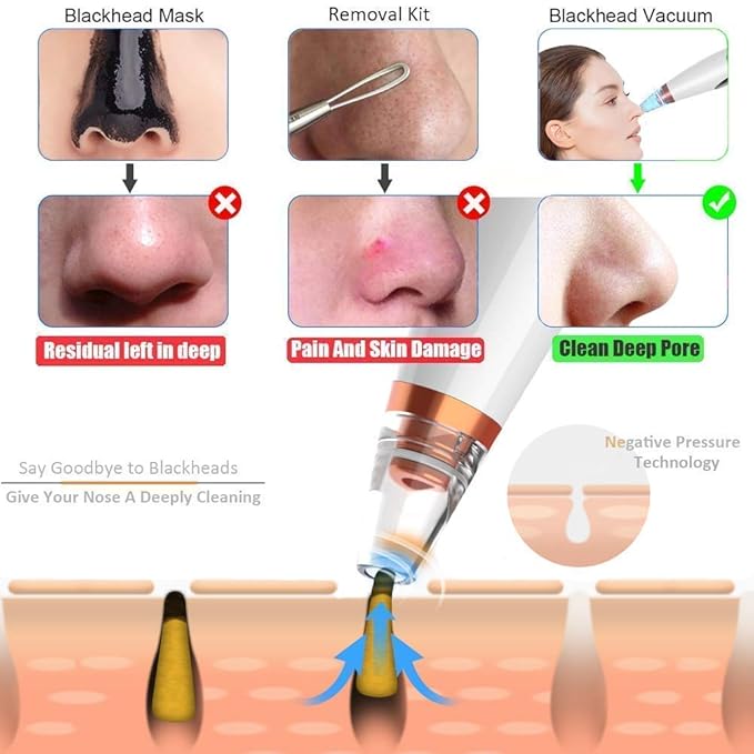 DermaGlow™ 6 In 1 Derma Suction blackhead remover machine
